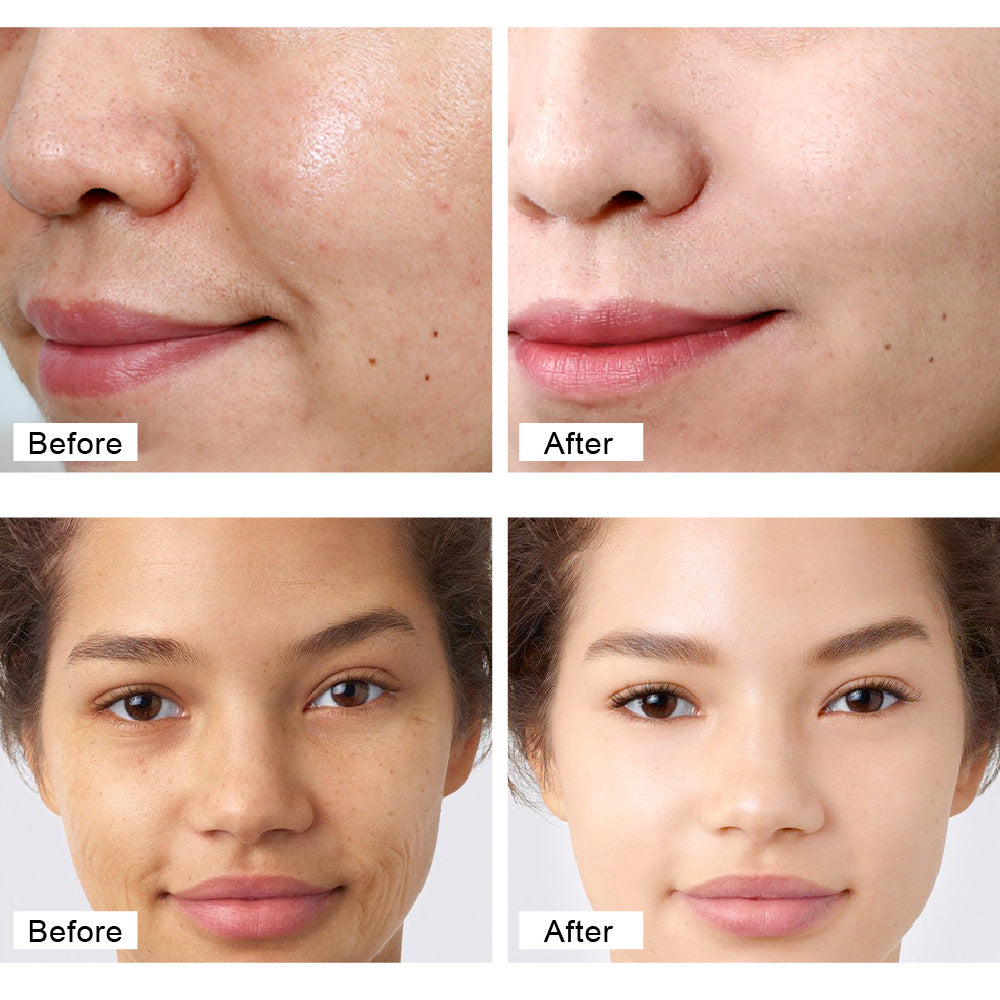Retinol Cream – Vitamin A, C & Arbutin, Double Potency