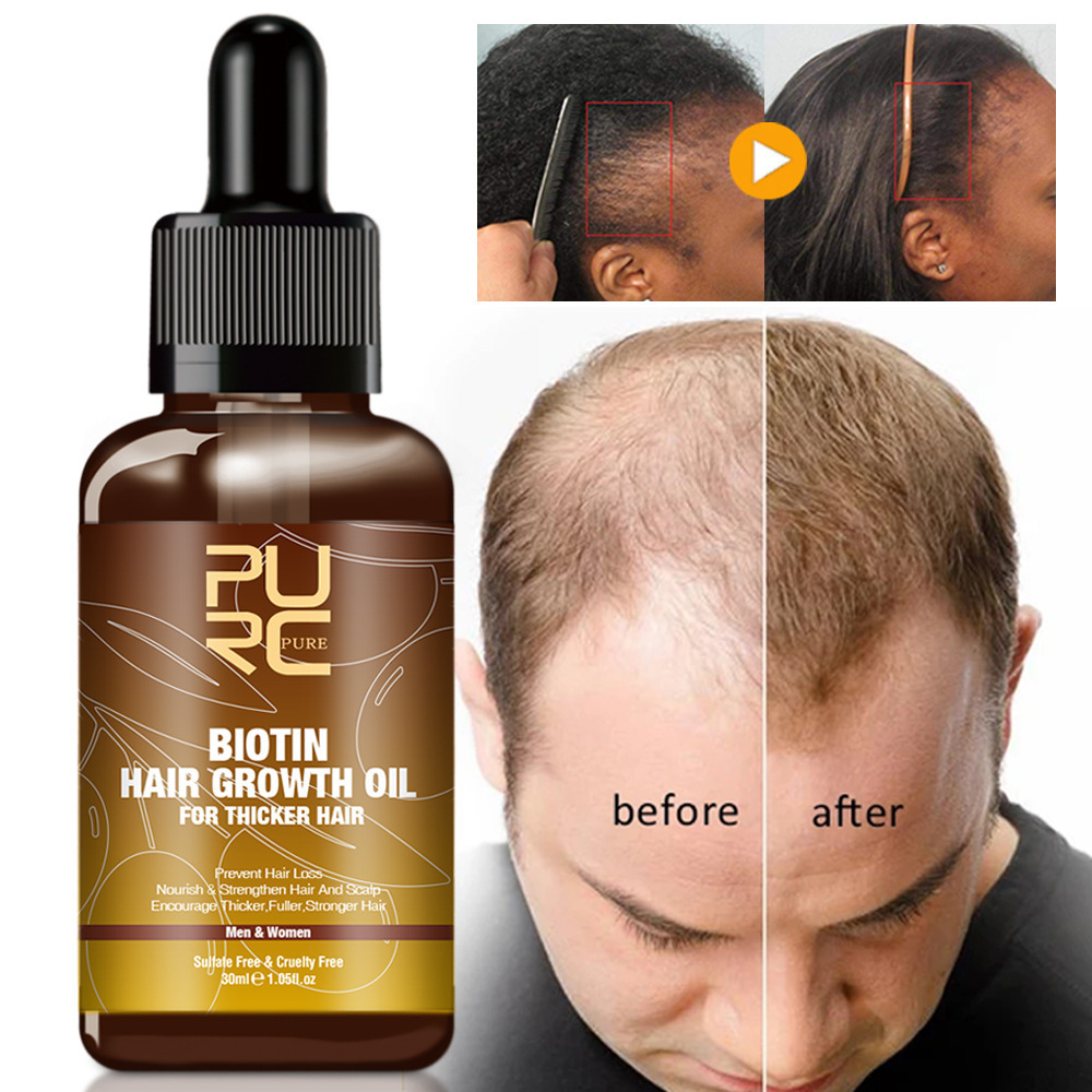 Ginger Biotin Hair Care Set