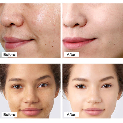 Retinol Cream – Vitamin A, C & Arbutin, Double Potency